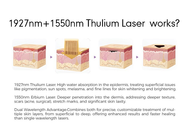 1550nm and 1927nm Dual-wavelength laser machine 1550nm and 1927nm Dual-wavelength laser machine