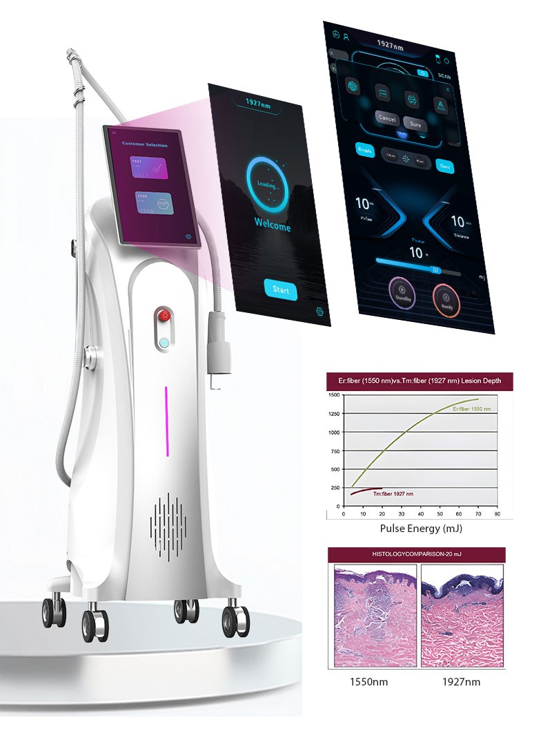 1550nm and 1927nm Dual-wavelength laser machine 1550nm and 1927nm Dual-wavelength laser machine